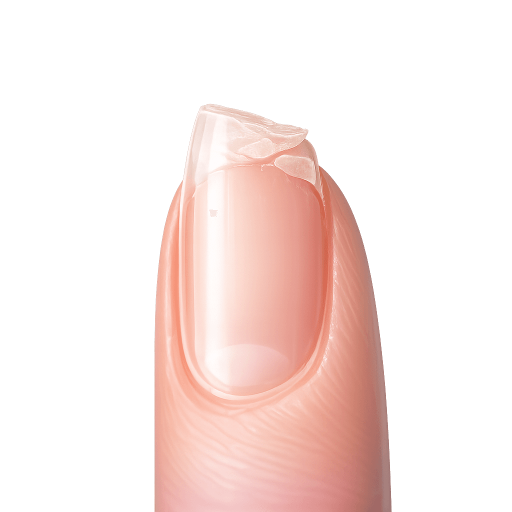 SPLITTING, BREAKING NAIL?
