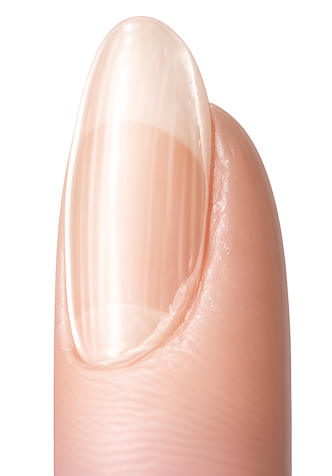 THICK, INFLEXIBLE NAIL?