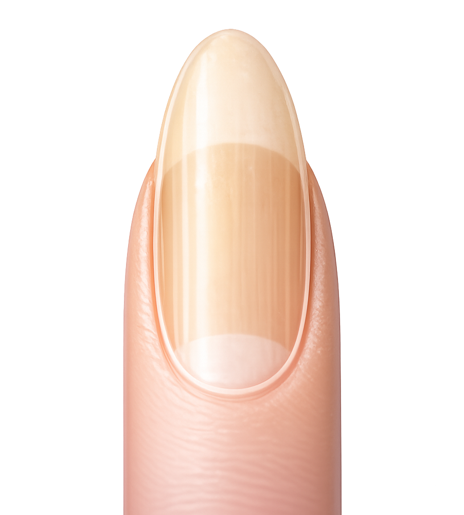 YELLOW, STAINED, DULL NAIL?