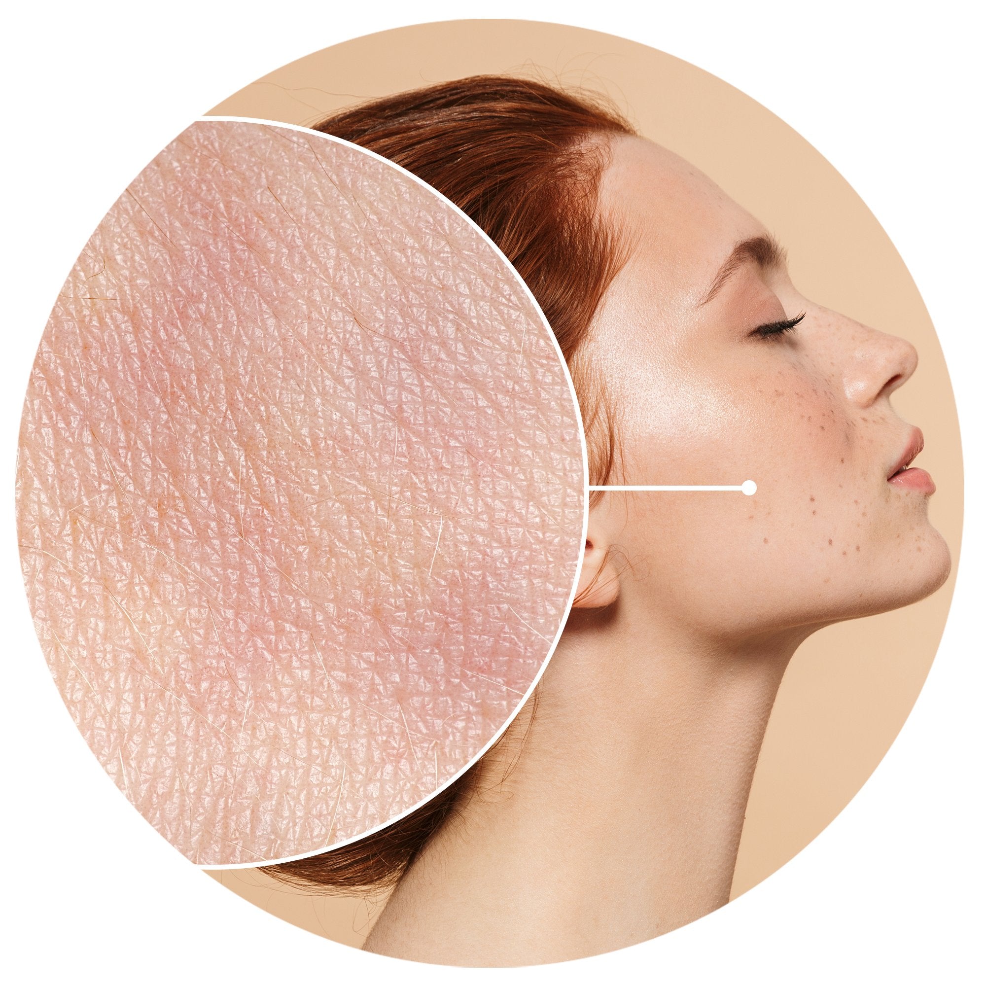 BLOTCHY COMPLEXION?