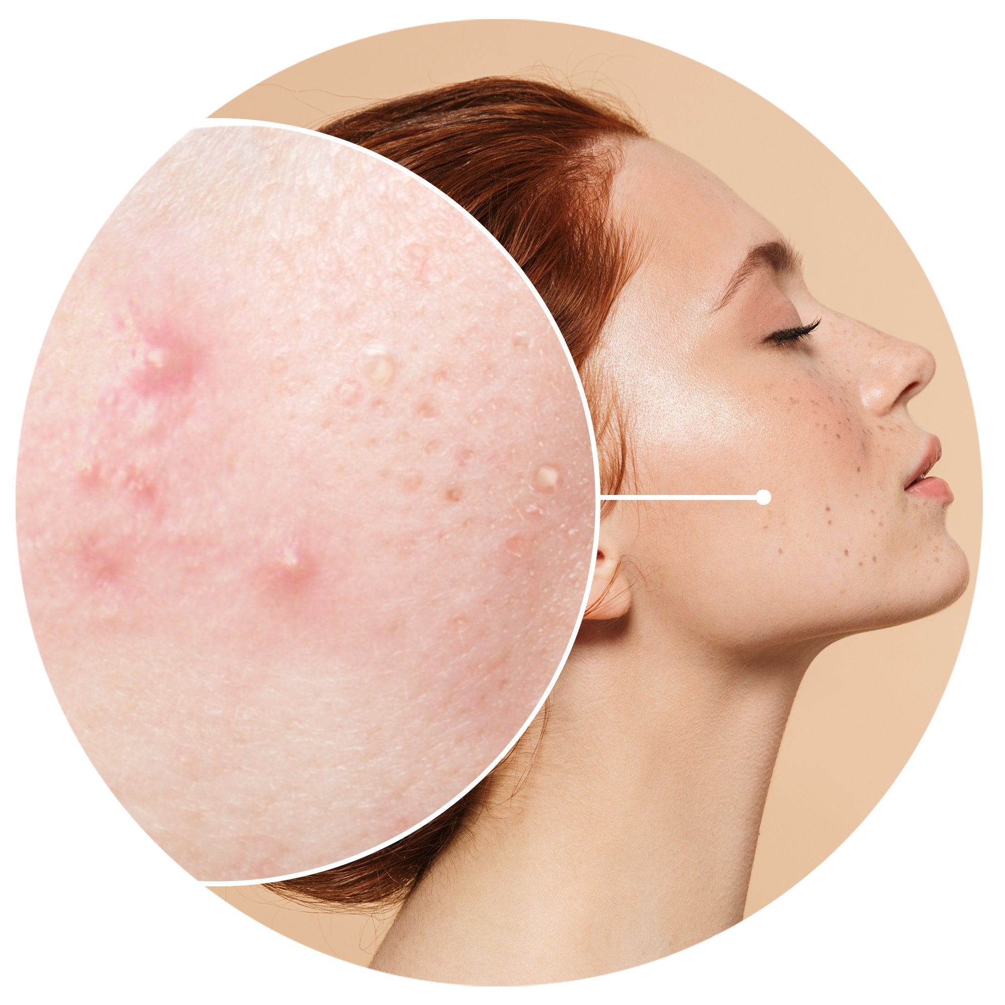 CLOGGED SKIN?