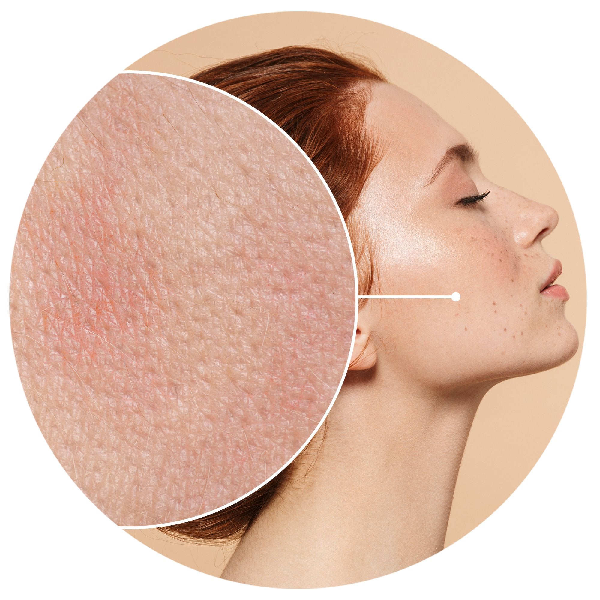 COMPLEXION WITH IRREGULARITIES?