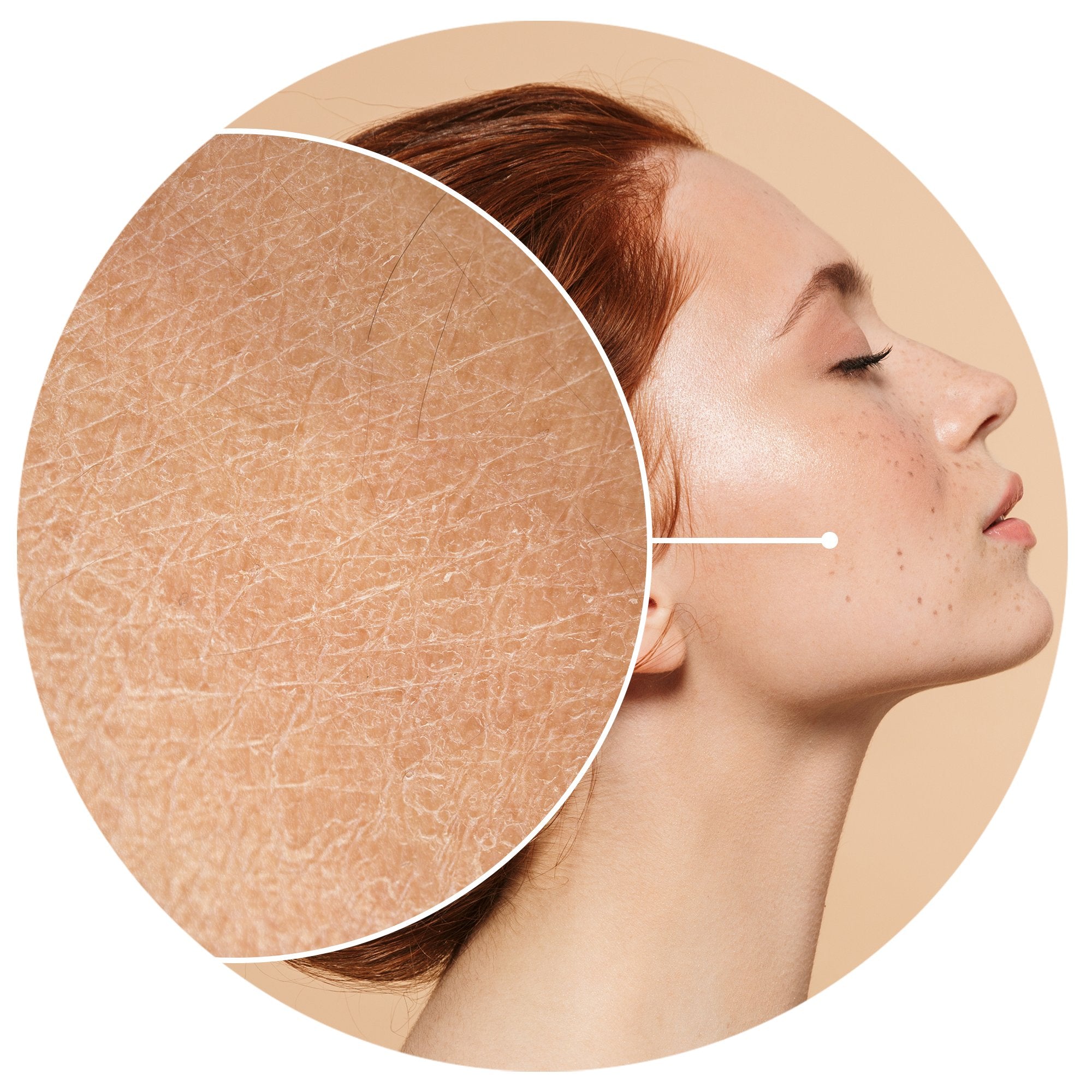 DEHYDRATED SKIN?