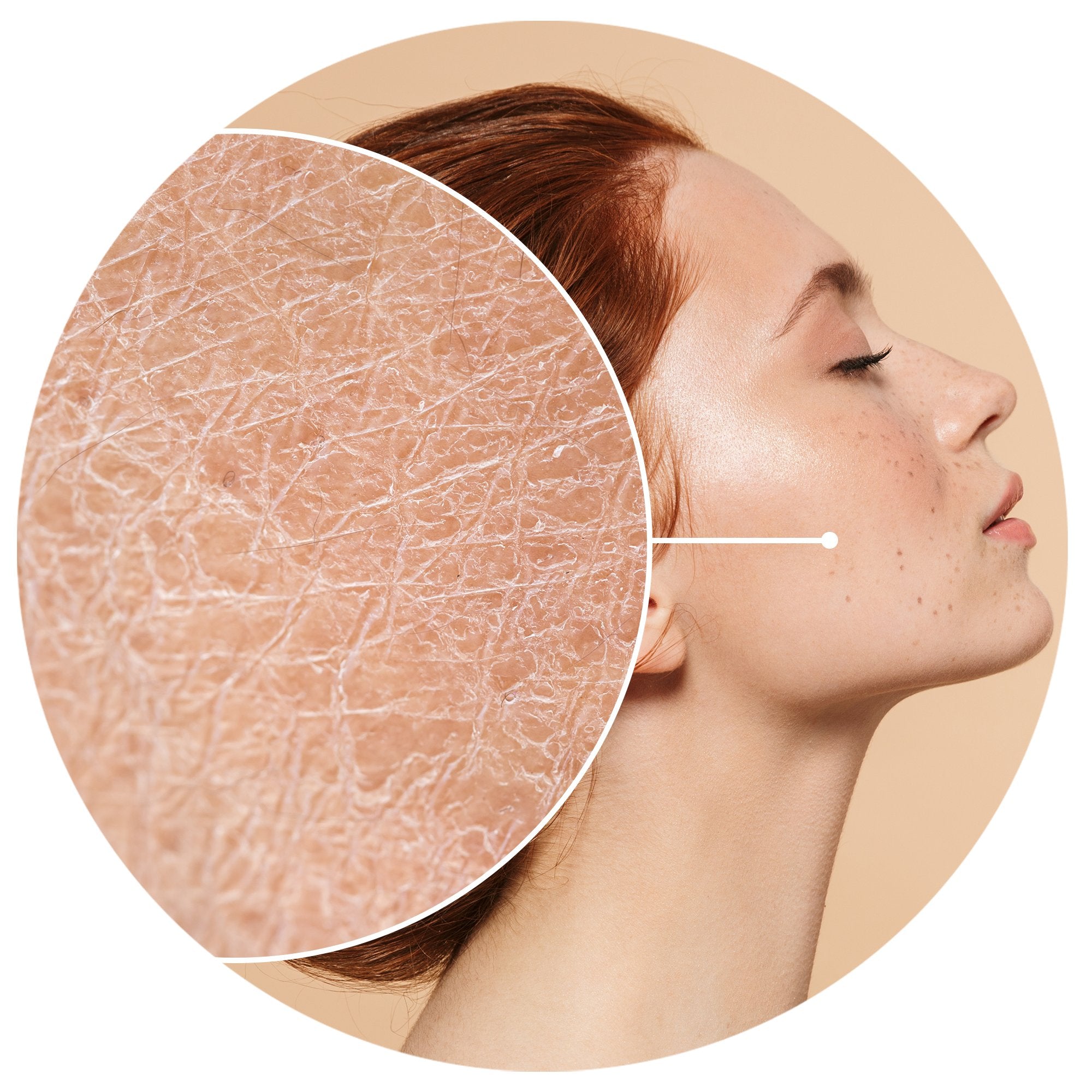 DRY SKIN?