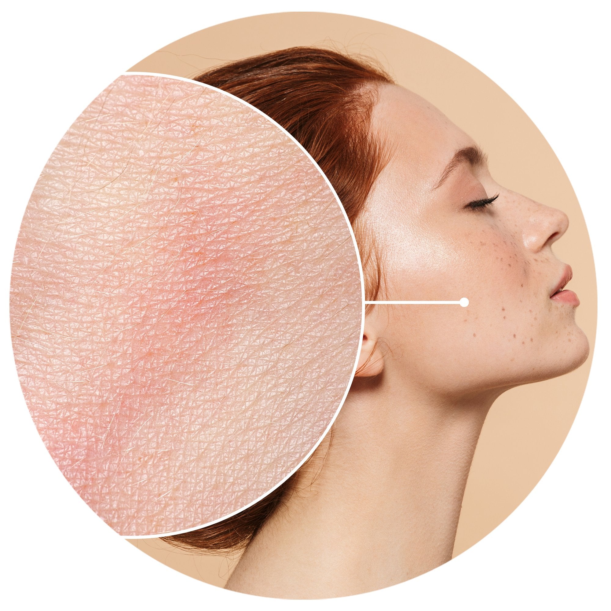 UNEVEN COMPLEXION?