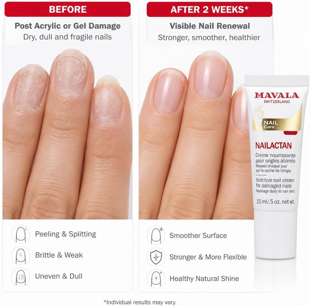 Before and after photographs of the same hand after gel or acrylic removal: dry, dull, uneven nails, then smoother nails with a natural shine, beside a tube of MAVALA Nailactan.