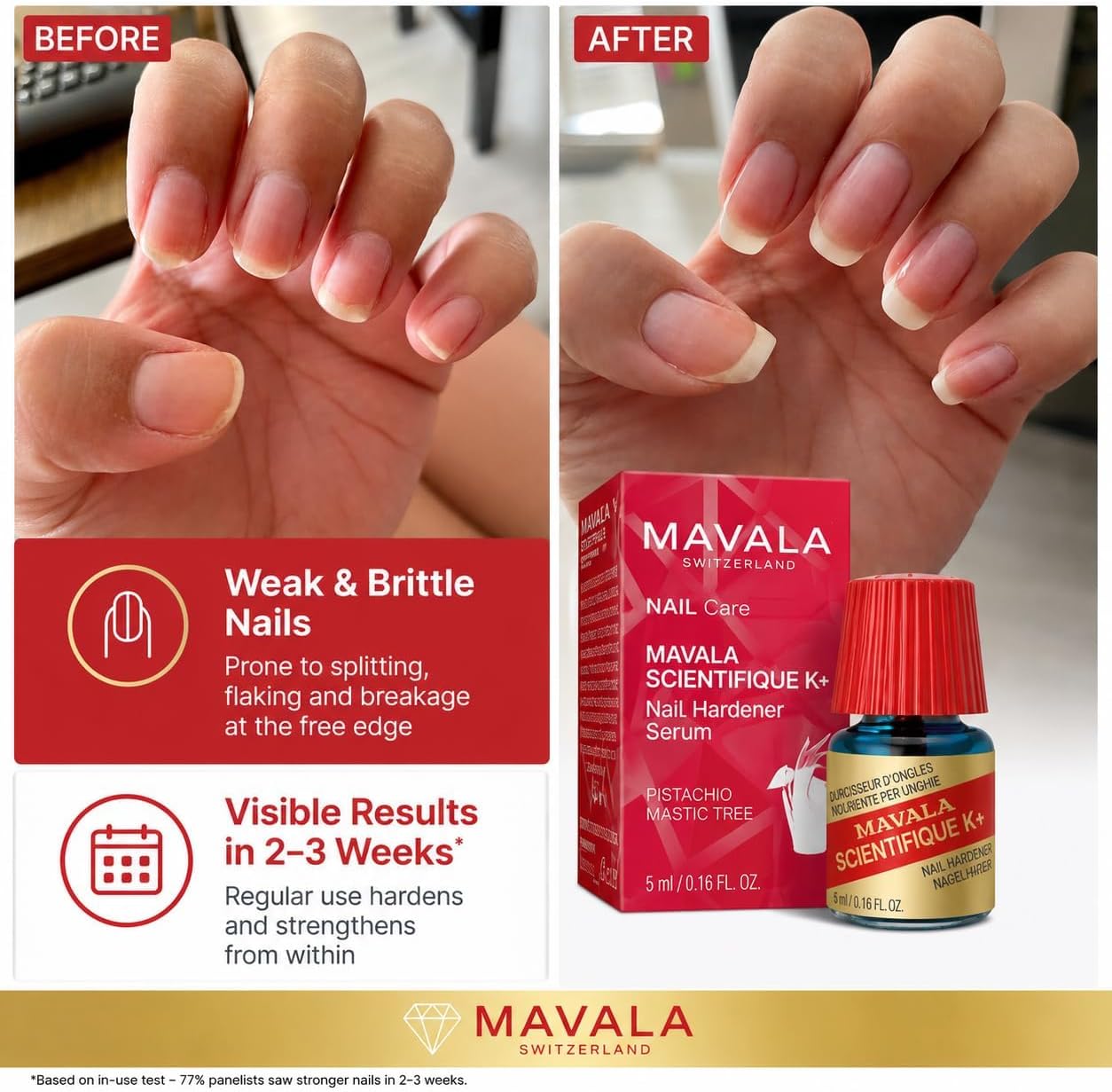 Before and after photographs of the same hand: nails splitting and flaking at the free edge, then longer and smoother nails, shown beside MAVALA Scientifique K+ and its carton.