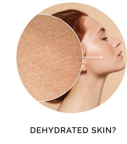 DEHYDRATED SKIN?