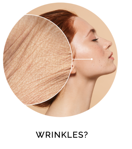 WRINKLES?
